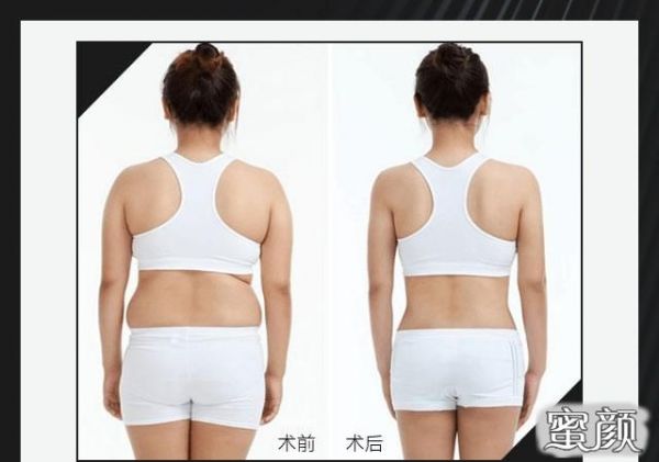 https://img.miyanlife.com/mnt/timg/230503/214415G02-1.jpg
