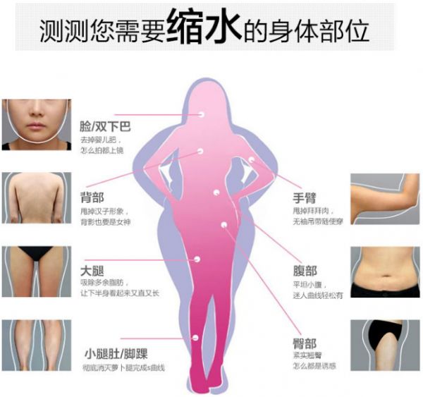 全身吸脂