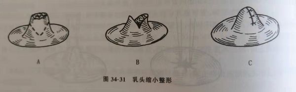 75291635635470157