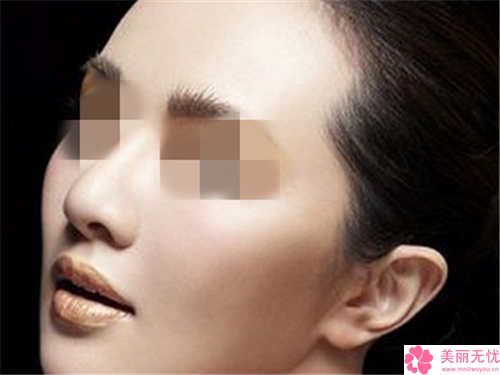 柳州市鼻再造手術(shù)價(jià)格表2024完整發(fā)布-柳州市人民醫(yī)院所需價(jià)格是多少