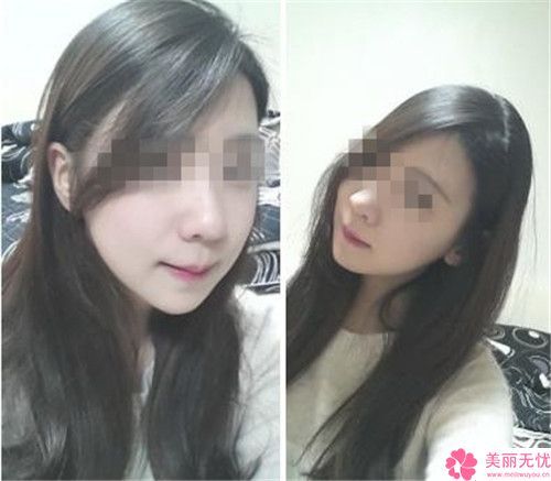 矫正歪脸医院推荐：矫正歪脸医院前30强信息一览