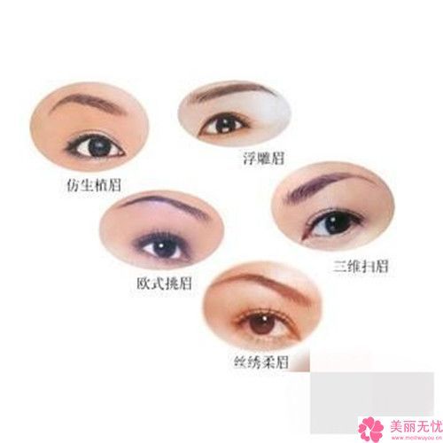 吉安玻尿酸注射眉弓的優(yōu)勢及適應人群