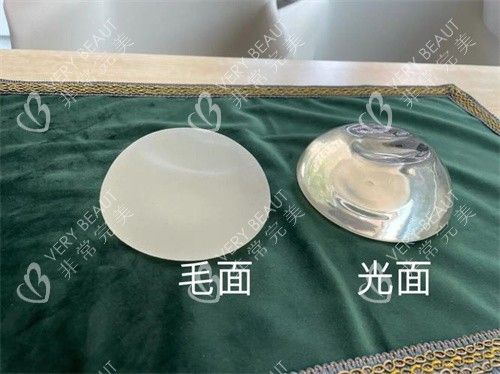 毛面假體和光面假體對比圖