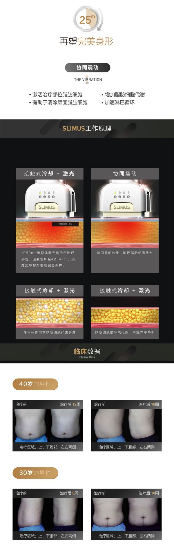 Slimus击脂塑减肥仪