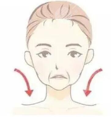 全臉脂肪填充剛做完圖感覺(jué)好丑幾天消腫后果很好真實(shí)案例