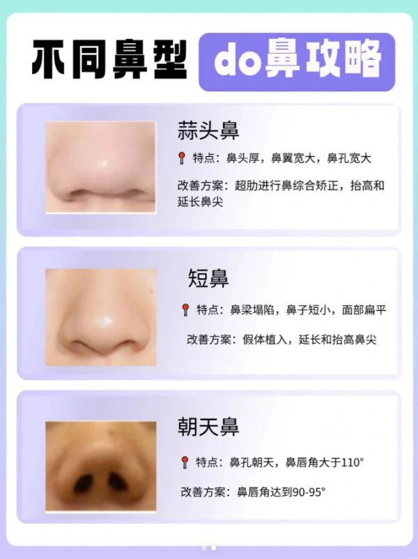 https://selfpage-gips.cdn.bcebos.com/708815f64cb3aeaf0b287114c490f92d.png