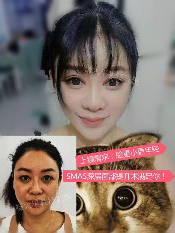 封面.jpg