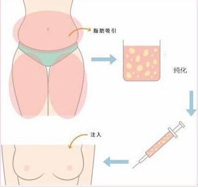 春雨醫(yī)生