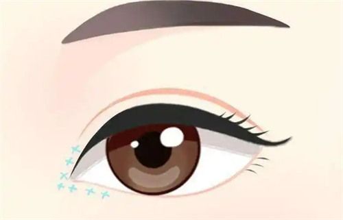 高士乾醫(yī)生簡(jiǎn)介曝光快來(lái)看，雙眼皮做得確實(shí)好價(jià)格也有哦
