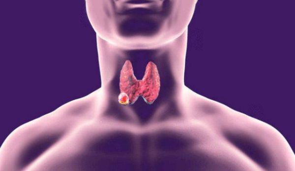 結(jié)節(jié)、息肉、囊腫？多半是痰瘀互結(jié)，送你兩味藥，健脾化瘀