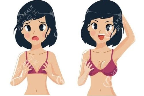 豐胸卡通對比圖