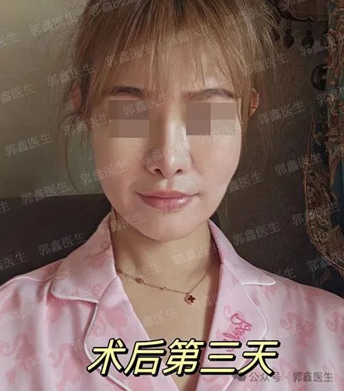 北京八大处郭鑫 整形修复品质口碑佳
