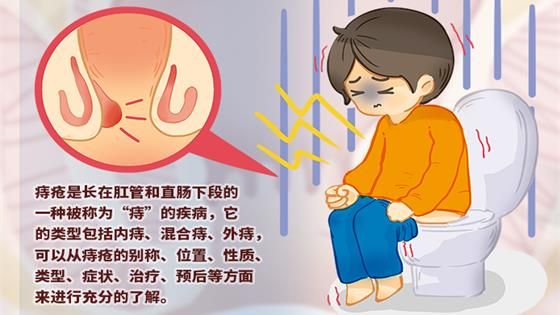 痔疮是什么样子的