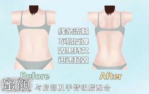 https://img.miyanlife.com/mnt/Editor/2023-03-31/64267a679b98b.jpg