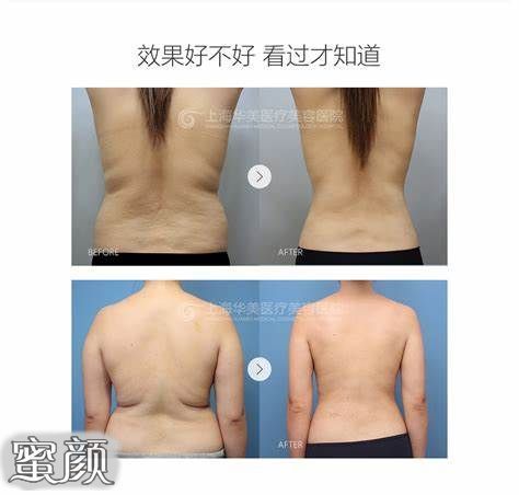 https://img.miyanlife.com/mnt/Editor/2023-03-31/64267a75dc240.jpg