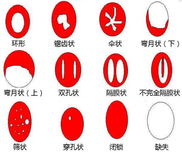 50991649289695323