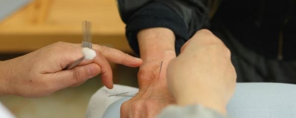 針灸的好處 針灸的壞處