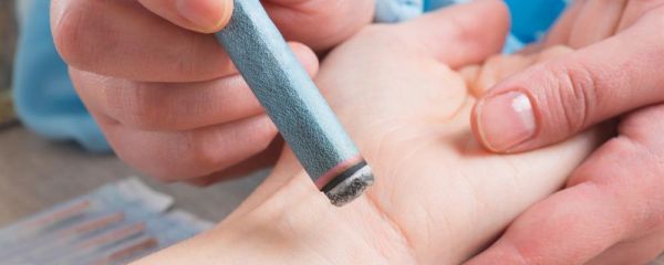 梅花針治頸椎病有效嗎 梅花針可以治療頸椎病嗎 梅花針怎么治療頸椎病