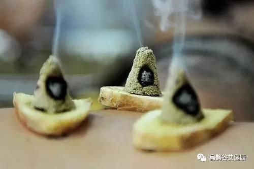 艾灸=增白針？99%的人都不知道！