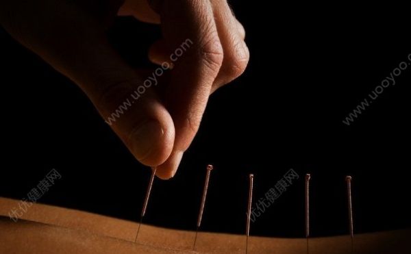 什么是針灸有什么作用？什么是針灸治病(1)