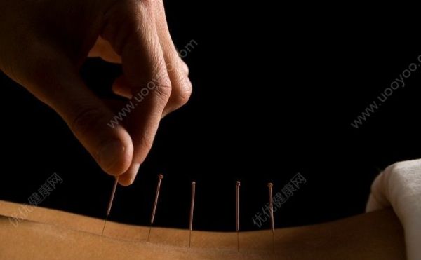 什么是針灸有什么作用？什么是針灸治病(3)