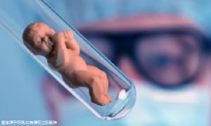 巧克力囊腫怎么治療比較好？是變相收費(fèi)嗎？