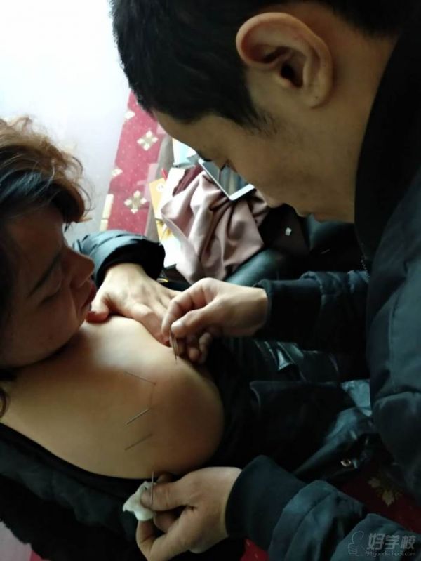 学员针灸练习