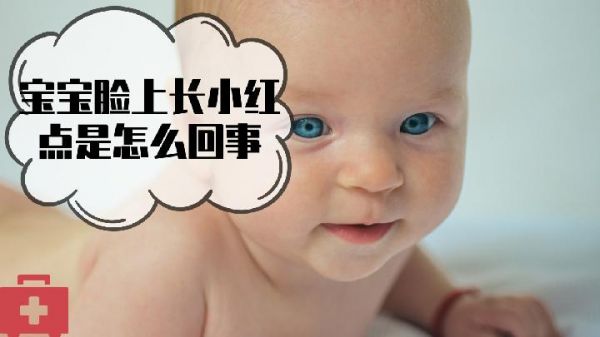 下巴长痘按什么穴位好 按此穴位清胃火有效改善痘痘
