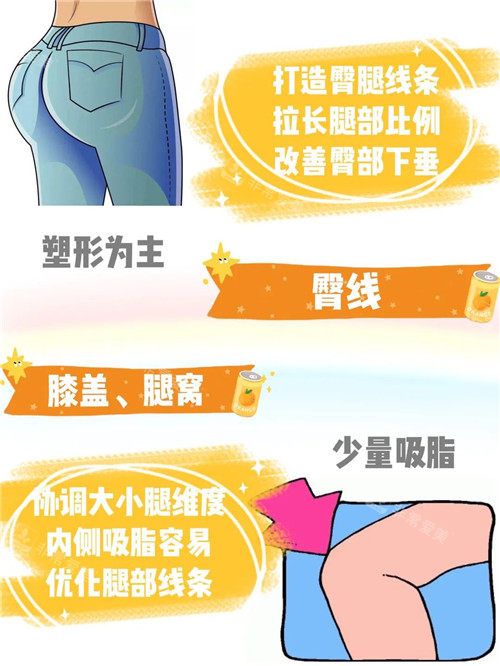 吸脂臀線的處理細(xì)節(jié)圖