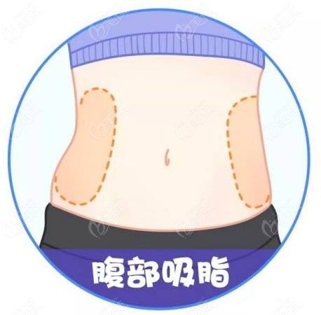 美貝爾快樂(lè)吸脂瘦腰腹有用www.236z.com