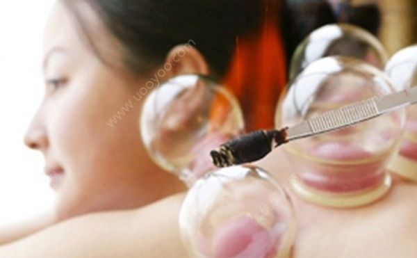 拔罐多久拔一次好？幾天拔罐一次好？(1)