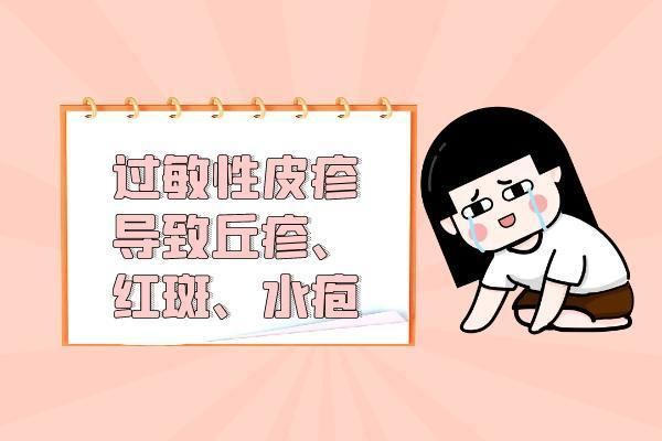 過敏性皮疹的癥狀 過敏性皮疹有什么表現(xiàn)？