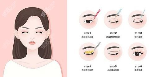 廣州呂方中收費(fèi)明細(xì)清單,7000元起做眼睛無(wú)負(fù)面評(píng)價(jià)值這個(gè)價(jià)