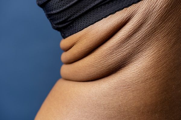 mujer con sobrepeso por grasas saturadas