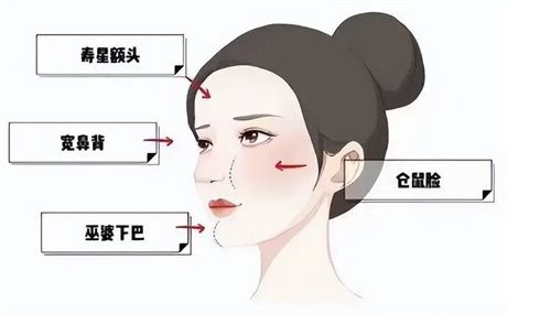 饅化臉哪個醫(yī)生做的好?2025饅化臉去除|修復(fù)醫(yī)生名單分享