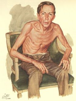 消瘦