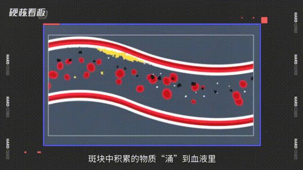一个年轻人的猝死全过程