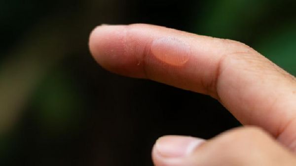 醋泡姜的養(yǎng)生功效及食用禁忌分別是什么？