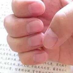 身体这五大情况暴露了健康隐患！