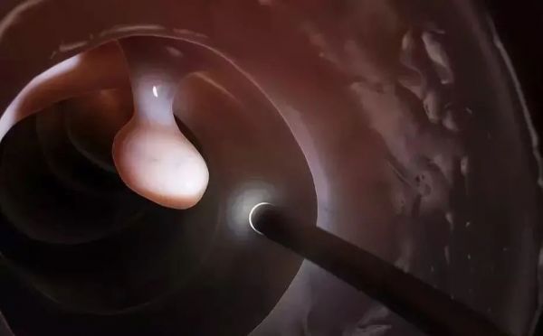 83011596409739443