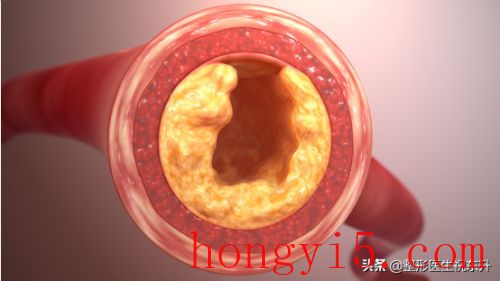 激光溶脂的危害(激光溶脂危害有哪些)插圖1