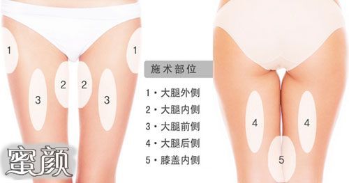 https://img.miyanlife.com/mnt/Editor/2022-01-18/61e699499648a.jpg
