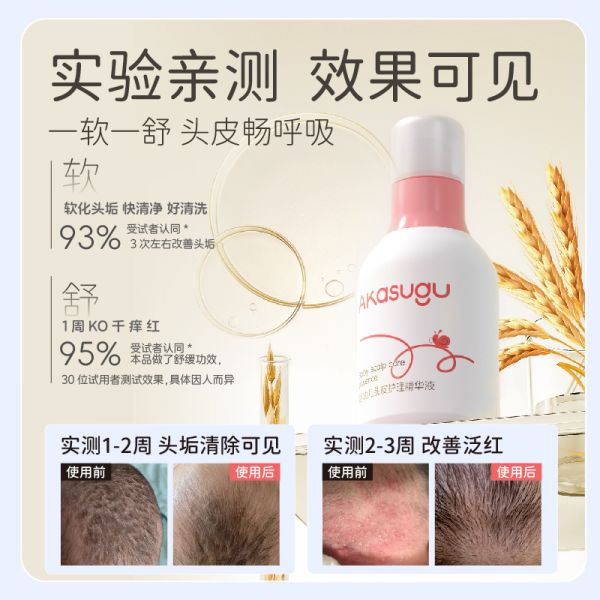 Akasugu愛舒屋嬰幼兒去頭垢油精華液4g
