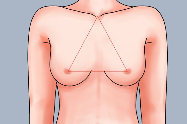 乳房位置和形态图