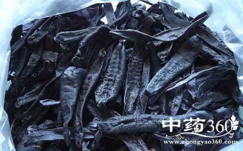 中醫(yī)治療血栓性靜脈炎 血栓性靜脈炎偏方 中醫(yī)偏方大全