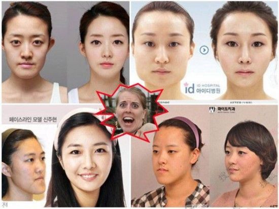 驚人韓國整容案例 五官巨變堪比換臉1