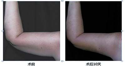 ip_image004l.jpg
