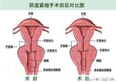 女性私密處健康的10件事，你可能不知道？