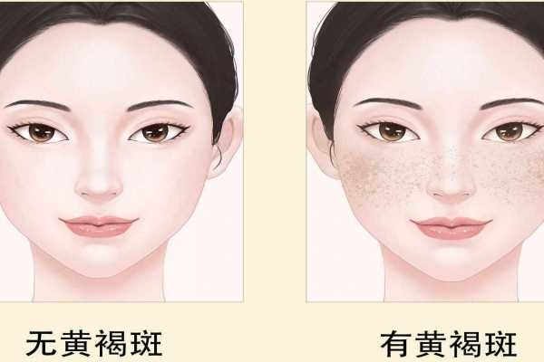 冬天減肥吃什么蔬菜最合適