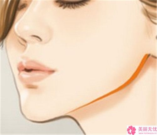 面部輪廓微對(duì)身體有怎樣的危害